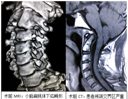 QQ圖片20160930155055.png